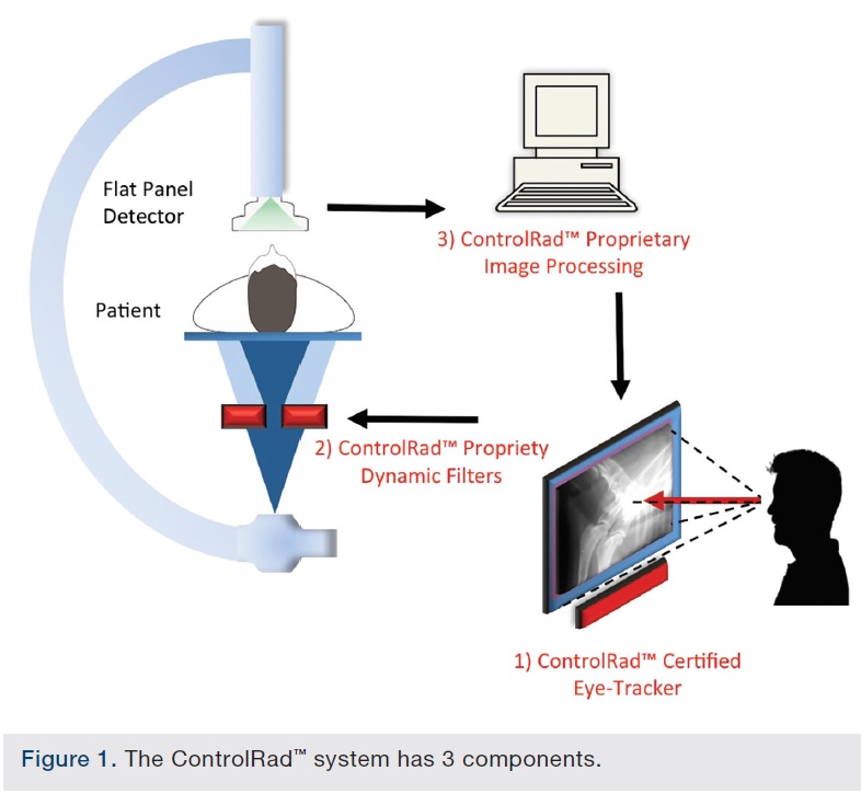 Reducing Radiation in the Cath Lab Using a Novel, EyeControlled